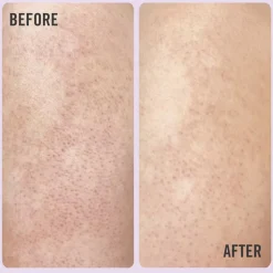 DAILY ESSENTIALS KP BODY SCRUB 10%