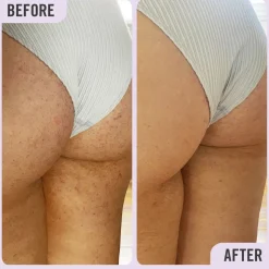 DAILY ESSENTIALS KP BODY SCRUB 10%