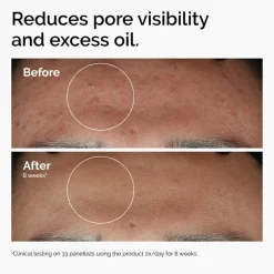 Niacinamide 10% + Zinc 1% 30 ml. Serum