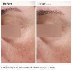 Niacinamide 5% Face and Body Emulsion