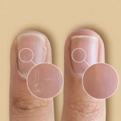 SolarOil Nail & Cuticle Treatment PEN