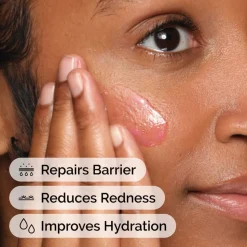 SOOTHING & BARRIER SUPPO 30ML/1FLOZ