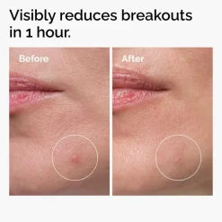 Sulfur 10% Powder-to-Cream Concentrate