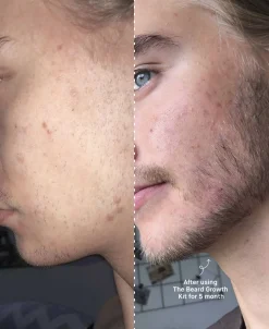 The Beard Growth Kit