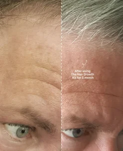 The Hair Growth Kit