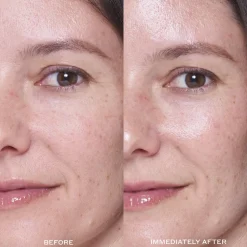 TRANSFORM Dewtopia 25% Acid Flash Facial